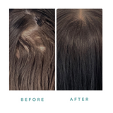 We Are Paradoxx Growth Advanced Scalp Serum 50ml streight on advanced scalp serum for thicker fuller hair trioplex technology before & after dark brown
