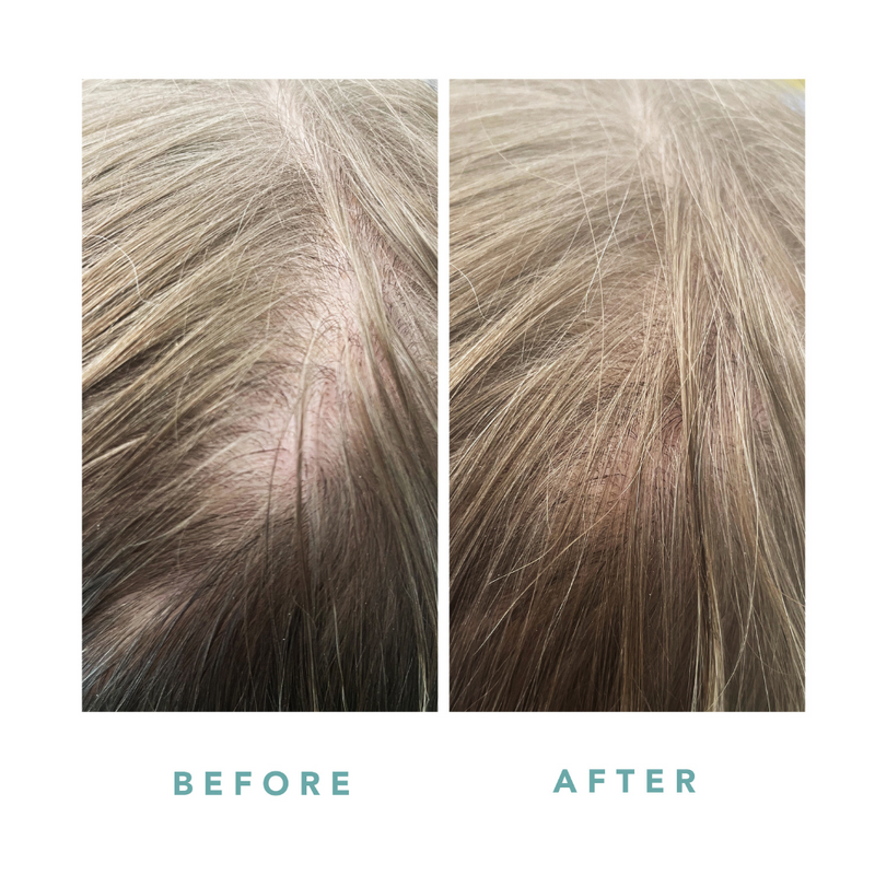 We Are Paradoxx Growth Advanced Scalp Serum 50ml streight on advanced scalp serum for thicker fuller hair trioplex technology dark blonde before and after 