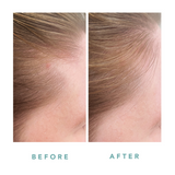 We Are Paradoxx Growth Advanced Scalp Serum 50ml streight on advanced scalp serum for thicker fuller hair trioplex technology   hairline thicker left