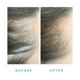 We Are Paradoxx Growth Advanced Scalp Serum 50ml streight on advanced scalp serum for thicker fuller hair trioplex technology   more hair