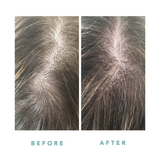 We Are Paradoxx Growth Advanced Scalp Serum 50ml streight on advanced scalp serum for thicker fuller hair trioplex technology before and after sark brown hair