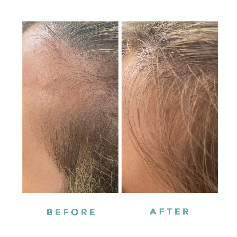 We Are Paradoxx Growth Advanced Scalp Serum 50ml streight on advanced scalp serum for thicker fuller hair trioplex technology  hair line thicker