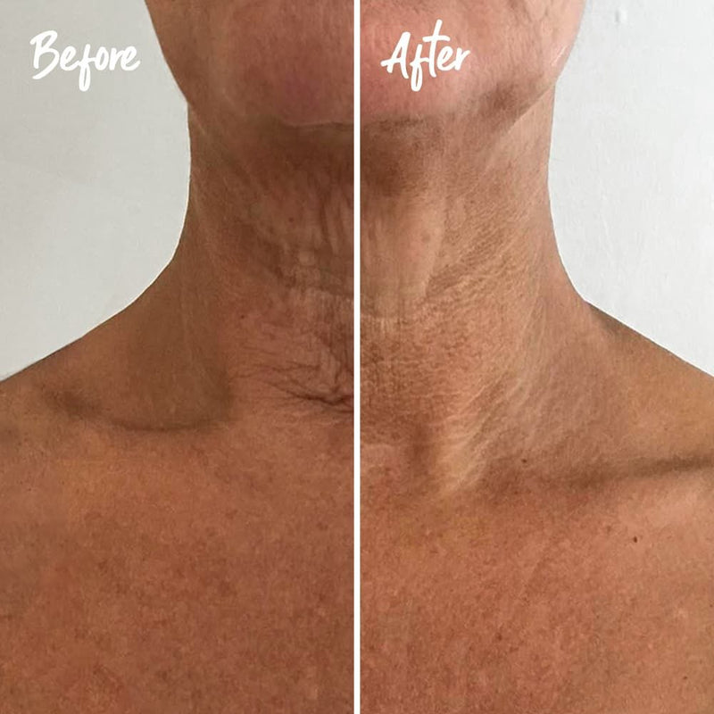 Instant Effects Neck and Chest Rejuvenating Serum 30ml before and after image 